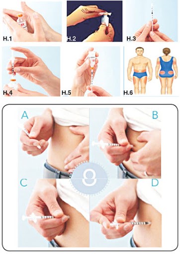 Hướng dẫn cách tiêm insulin tại nhà cho bệnh nhân đái tháo đường