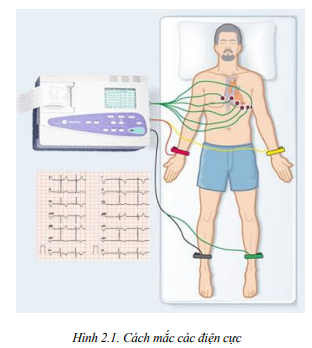 Điện tâm đồ trong bệnh lý tăng huyết áp