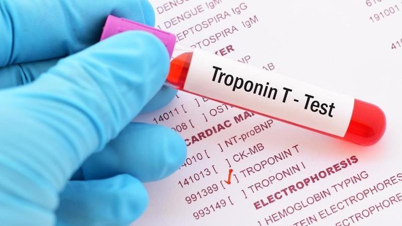 Xét nghiệm Troponin T và những thông tin cần biết trong chẩn đoán nhồi máu cơ tim